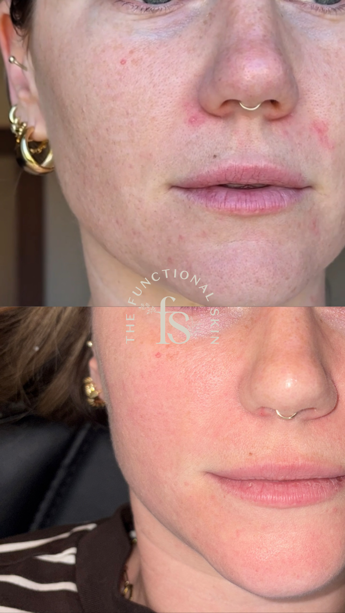 The Charlotte Calming Cream