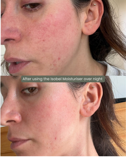 The Isobel Moisturiser
