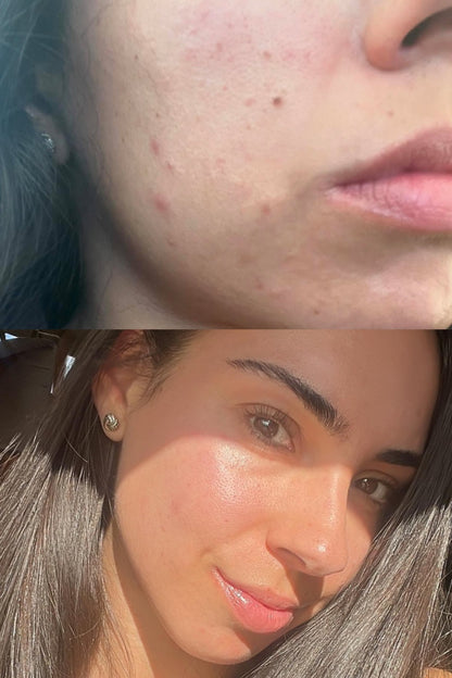 The Lily Cleanser