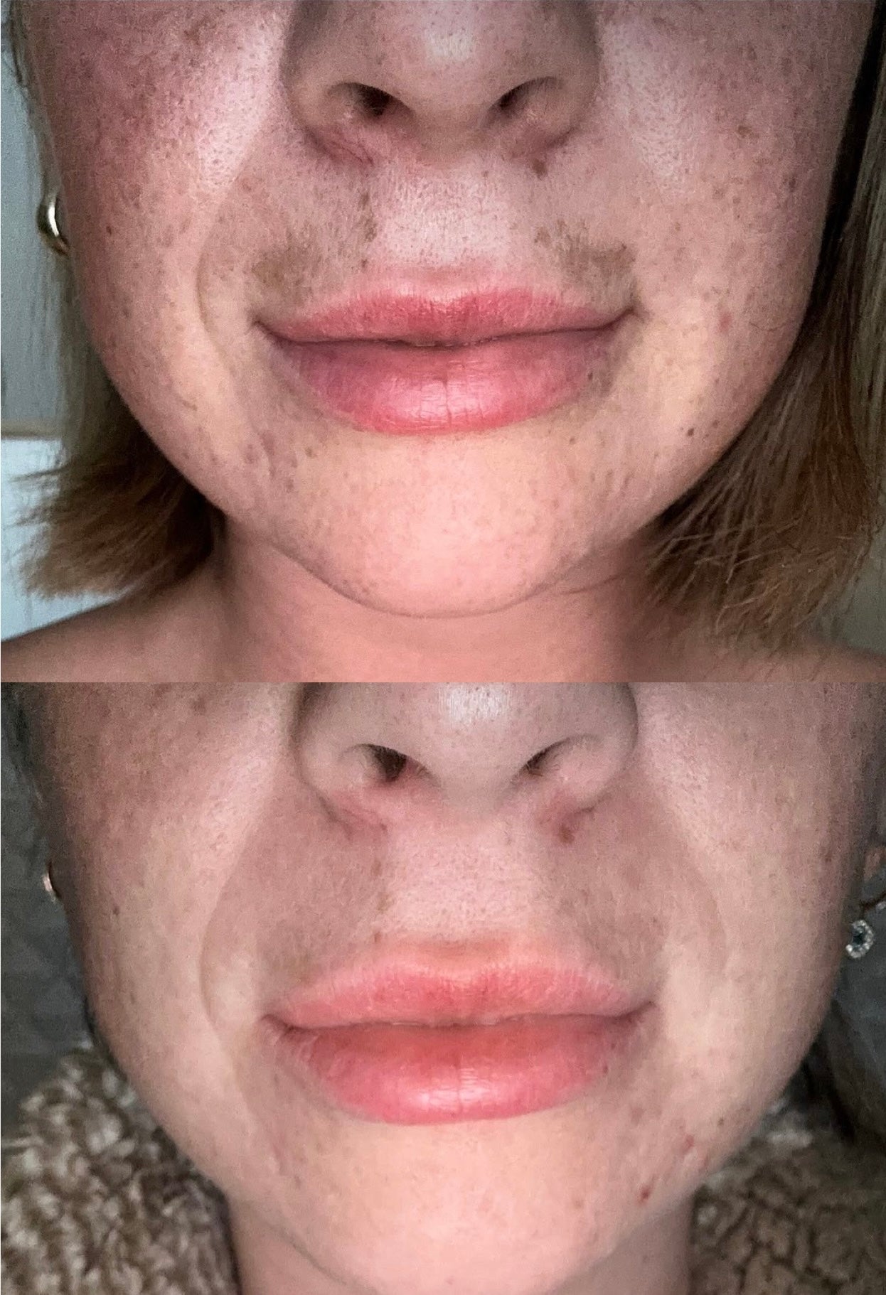Before and after comparison of a person's face.