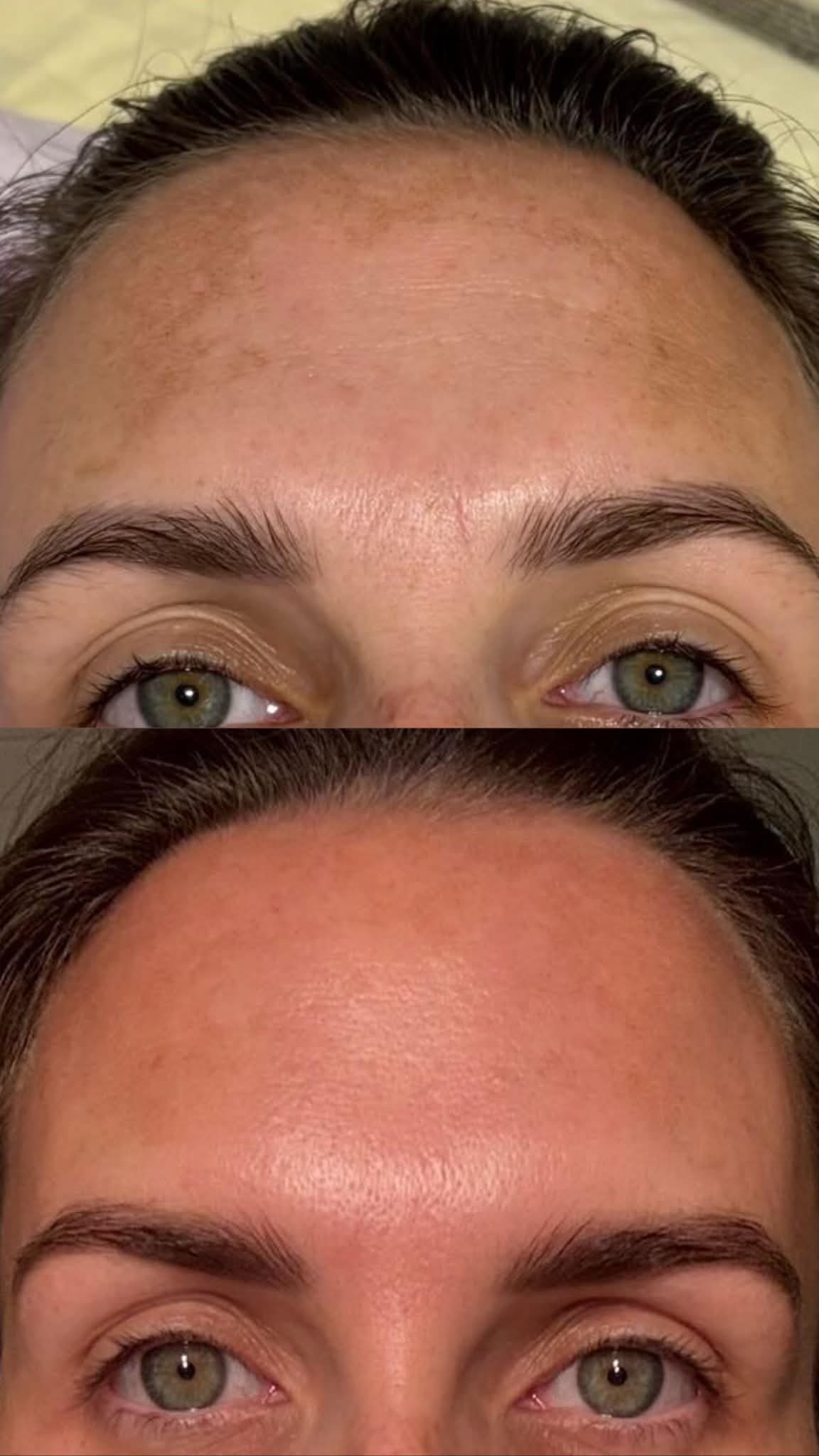 Before and after comparison of a woman's face with green eyes.