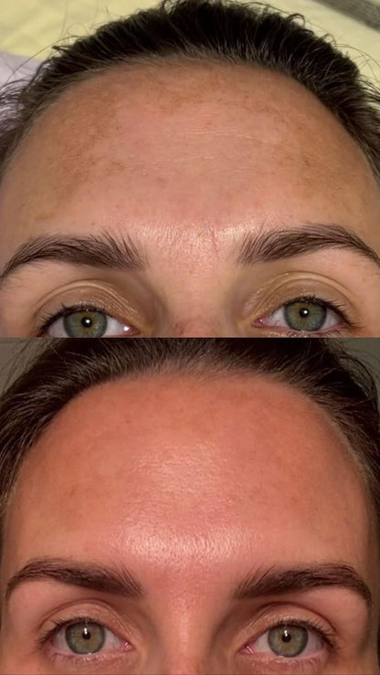 Before and after comparison of a woman's face with green eyes.