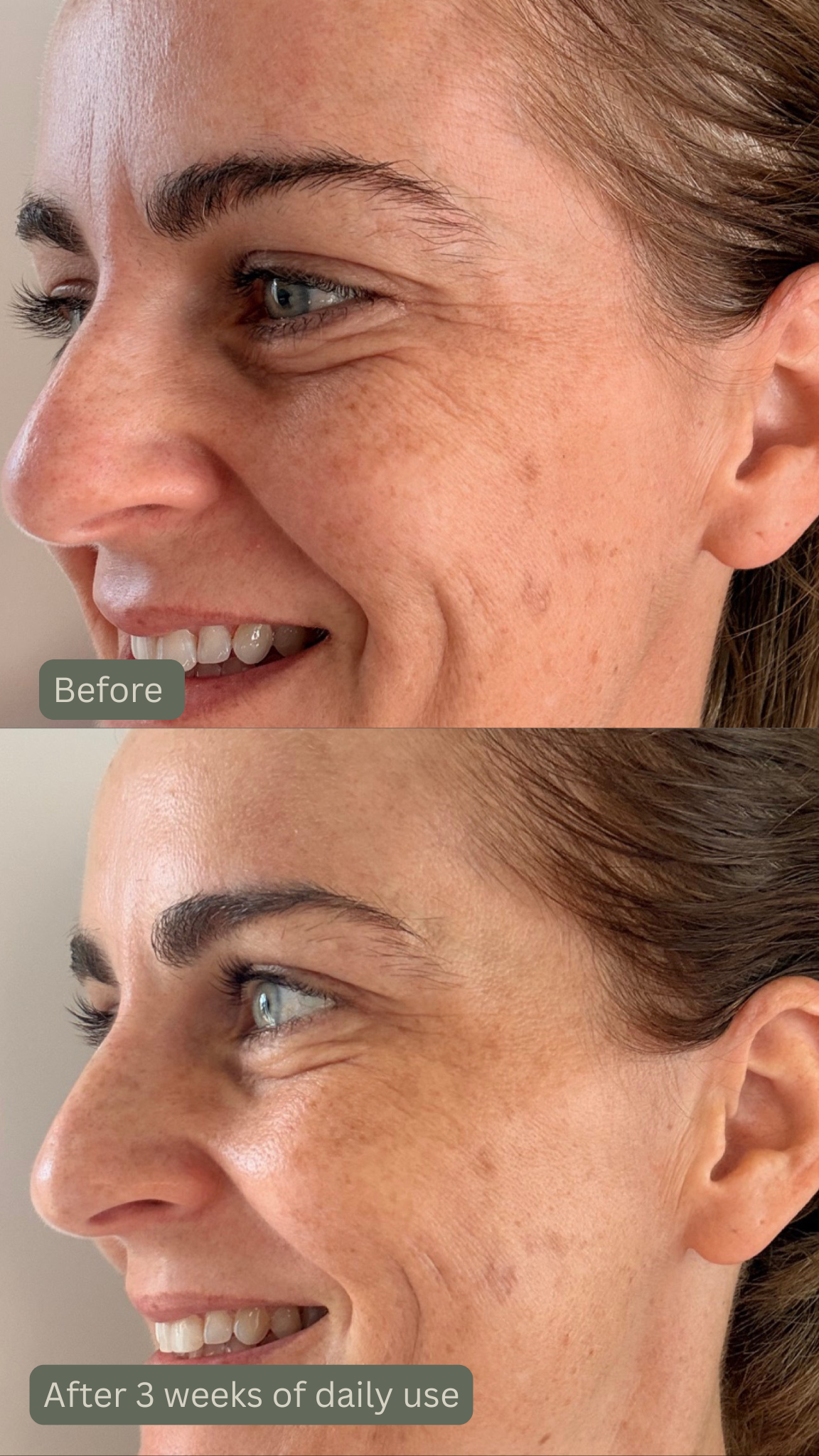 Before and after comparison of a woman's face showing the effects of The Audrey Age Renewal Mist over 3 weeks.