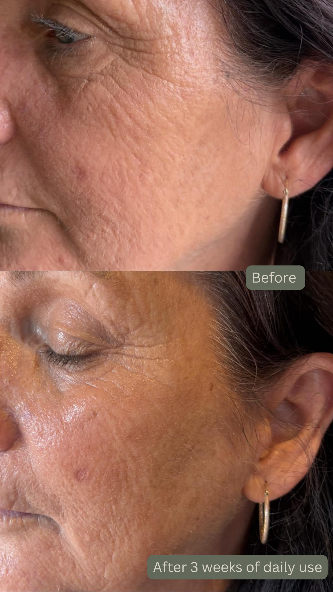 Before and after comparison of a woman's face showing skin texture improvement over 3 weeks.