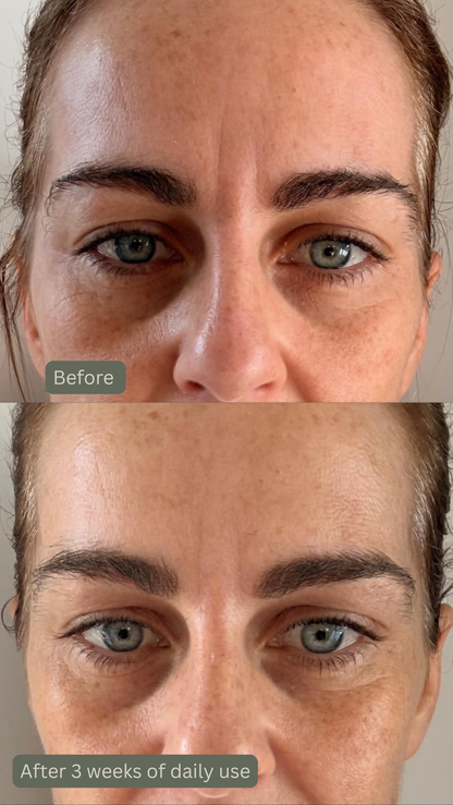 Before and after comparison of a woman's face showing the effects of daily use on skin texture and appearance.