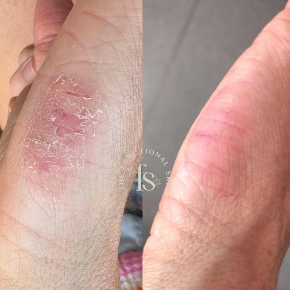 The Charlotte Calming Cream